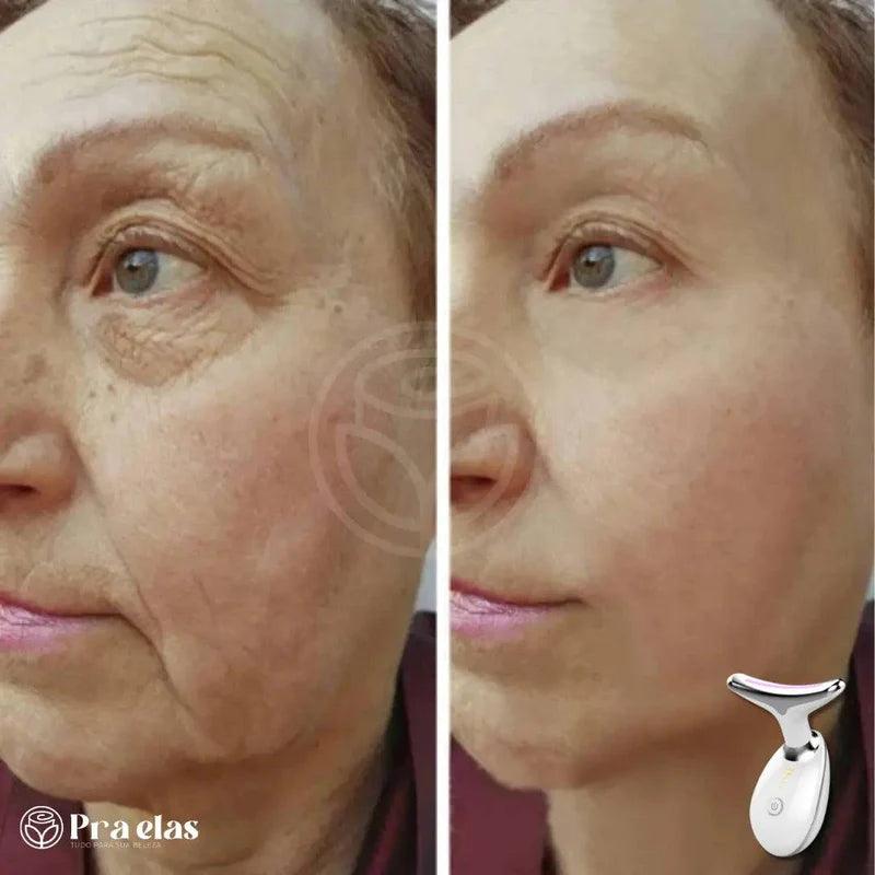 BioLift - Masajeador Facial (Fototerapéutico y Antiarrugas)